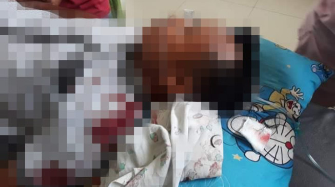 Ditembak OTK, Warga Malapari Dilarikan ke Rumah Sakit